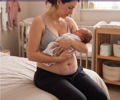 Mother holding newborn, scar strip visible on healing incision